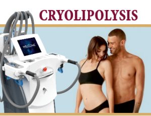 Cryolipolysis for weightloss