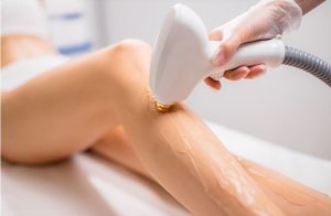 Hair Removal Permanent in Larnaca Near Me | Body Care 2022
