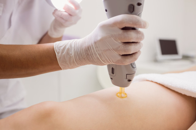 diode laser permanent hair removal