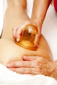 cupping therapy for cellulite